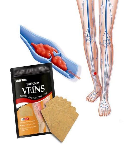 Flasteri Za Proširene Vene i Cirkulaciju